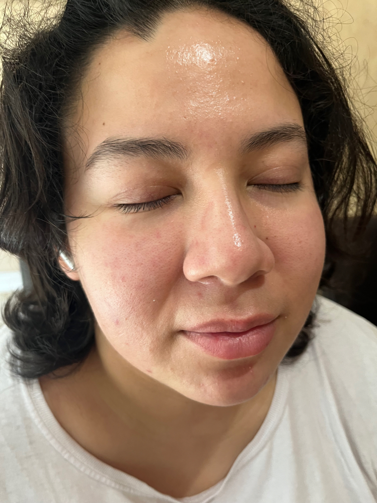 Dermaplaning