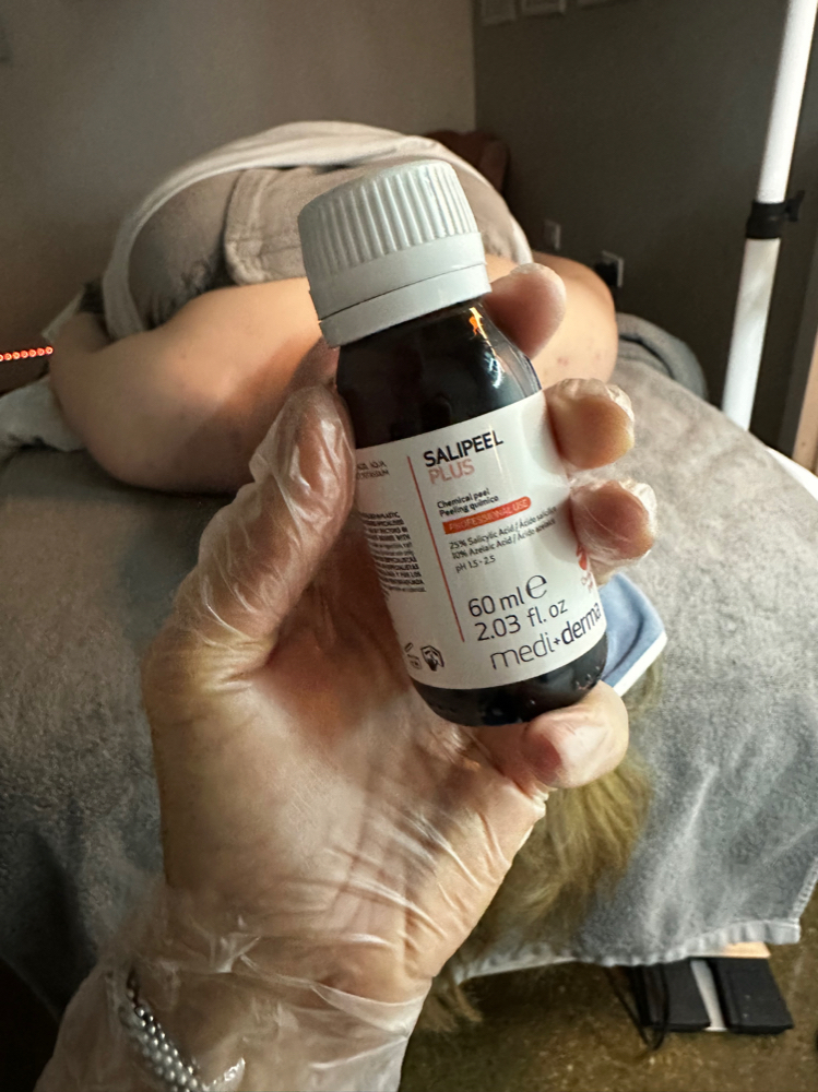 Only Peel( No Extraction)