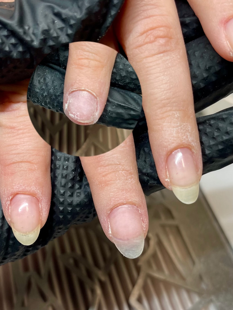 Nail Fix