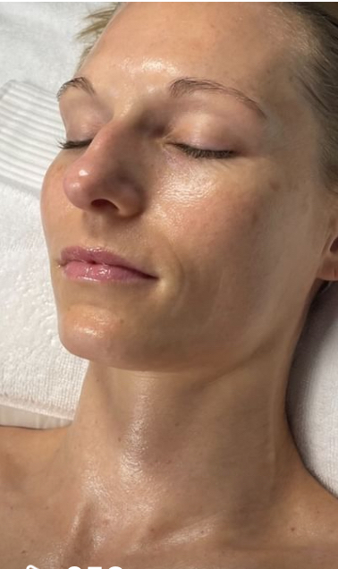 Ultimate Glow Facial