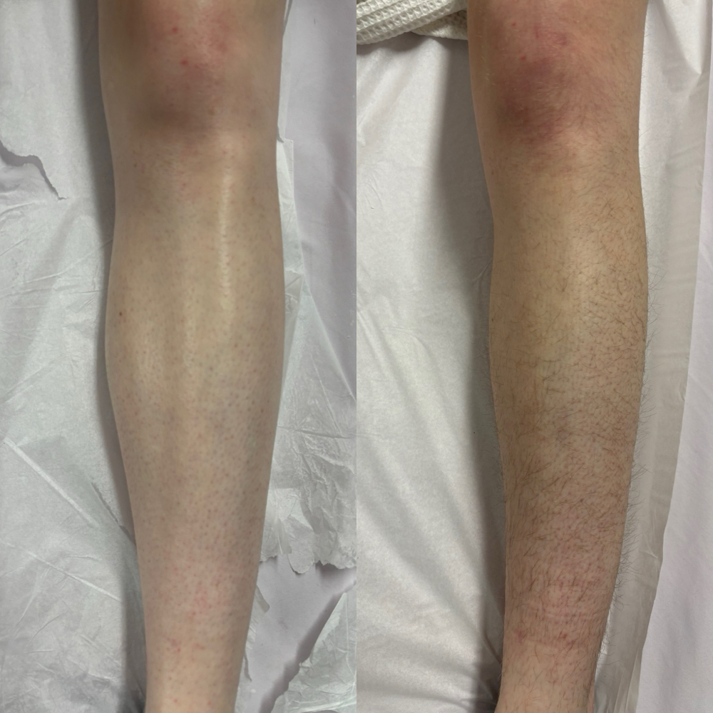 Full Leg Wax