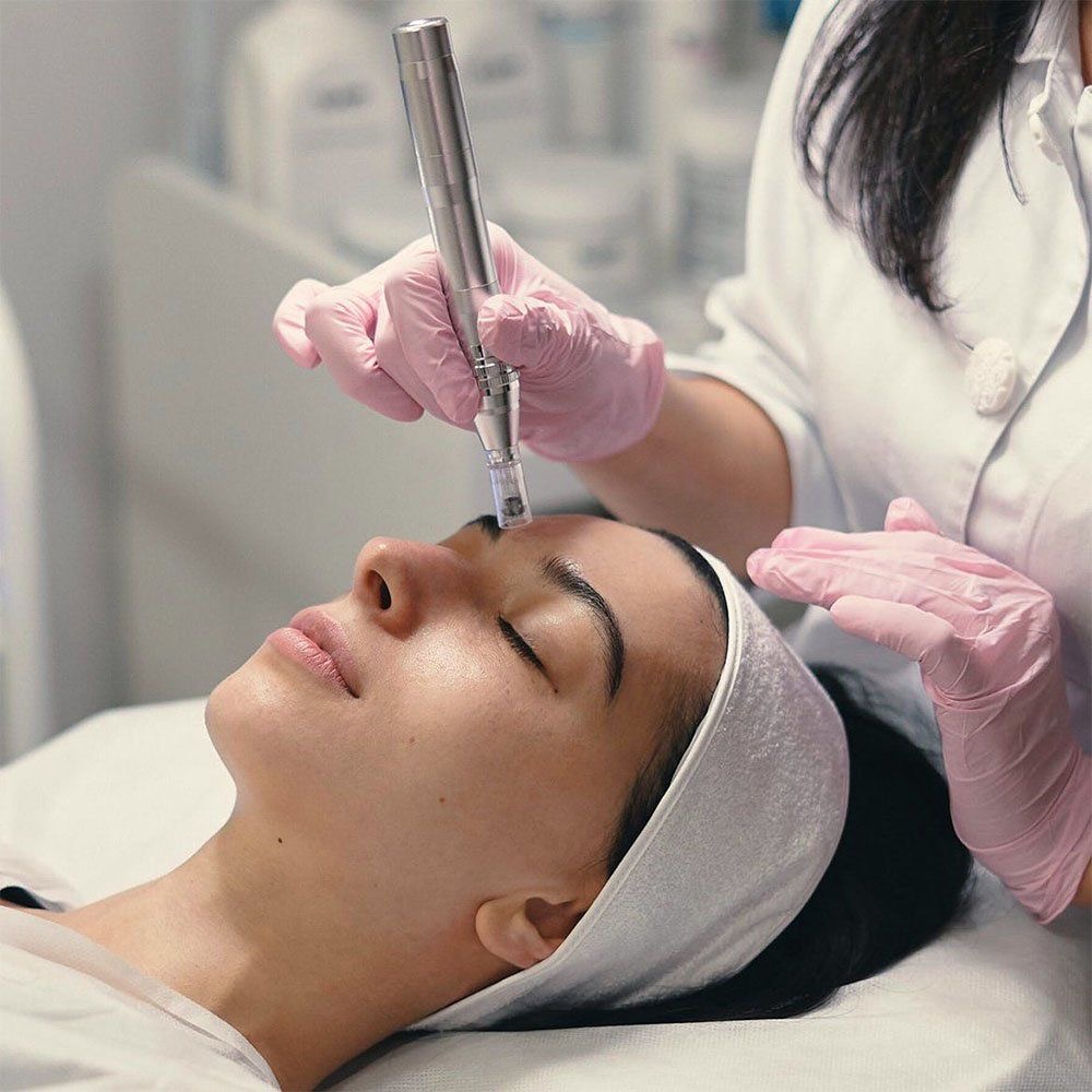 Cosmetic Microneedling