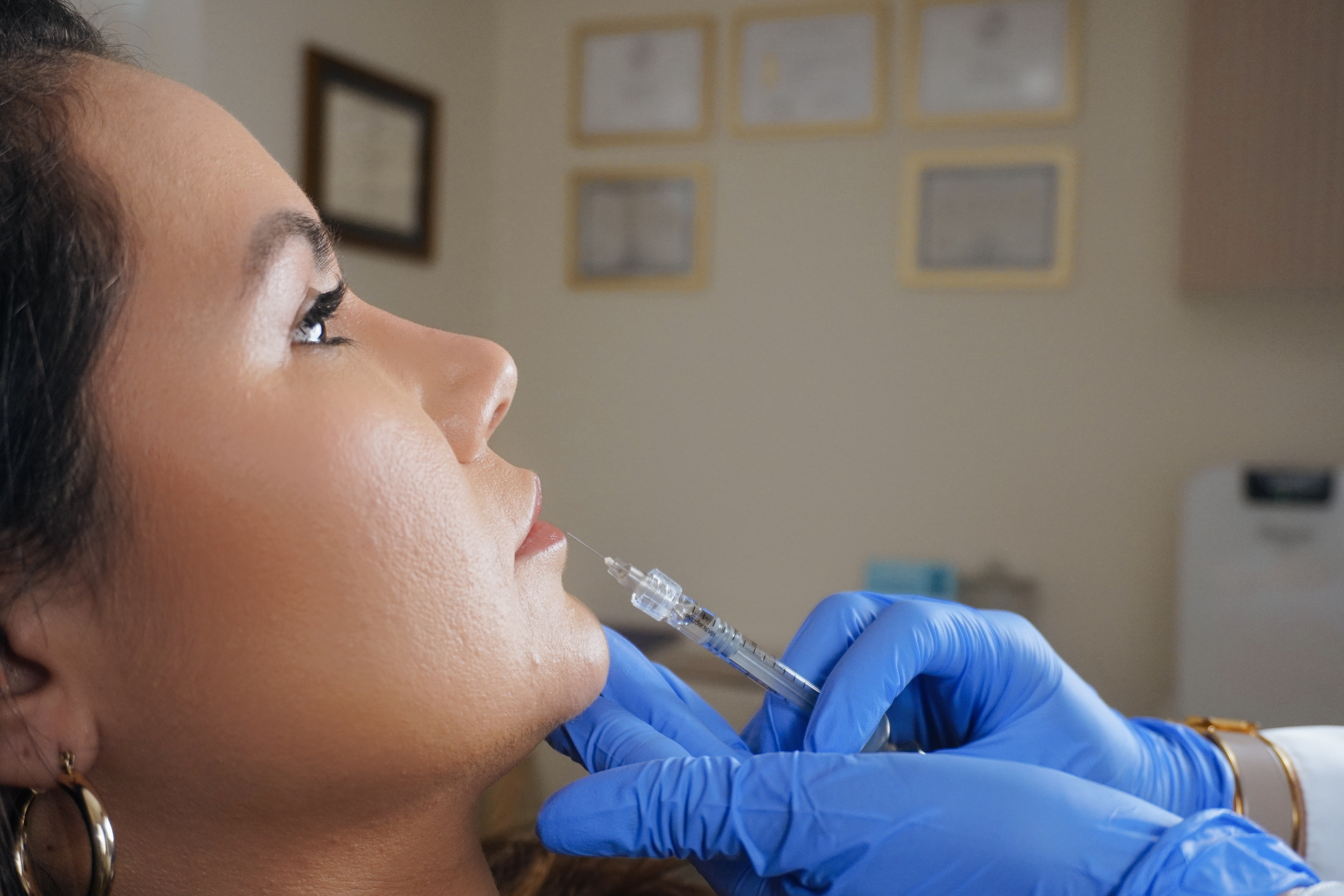 Luxe Lips - Full Syringe