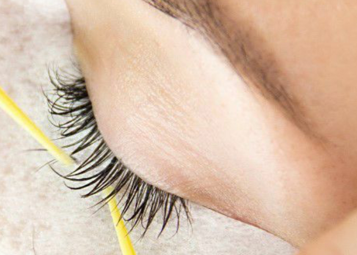 LASH REMOVAL
