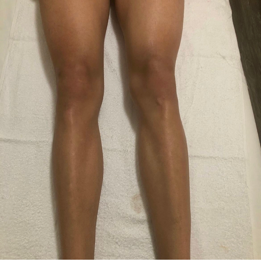 Legs
