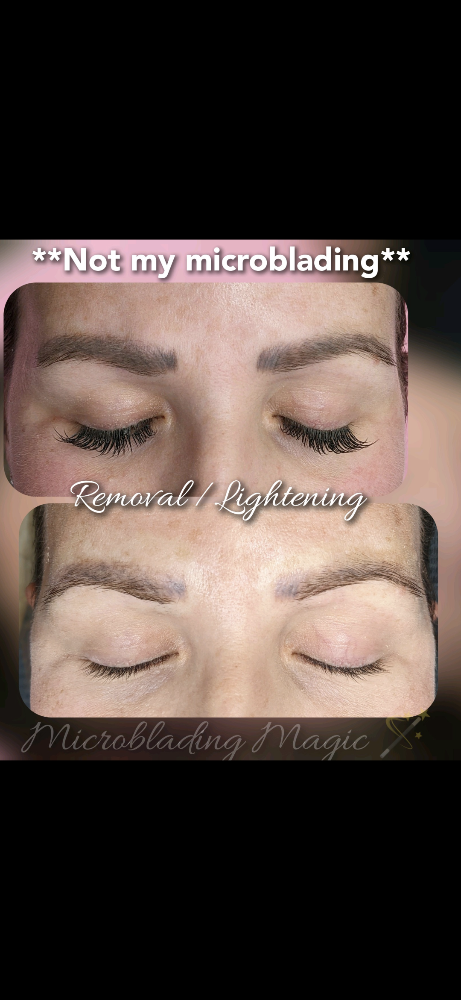 Lightening/Removal (Single Session)