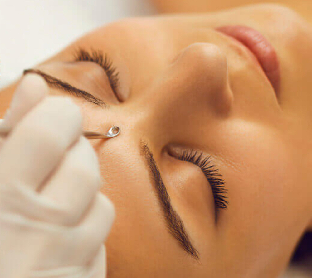 Extractions