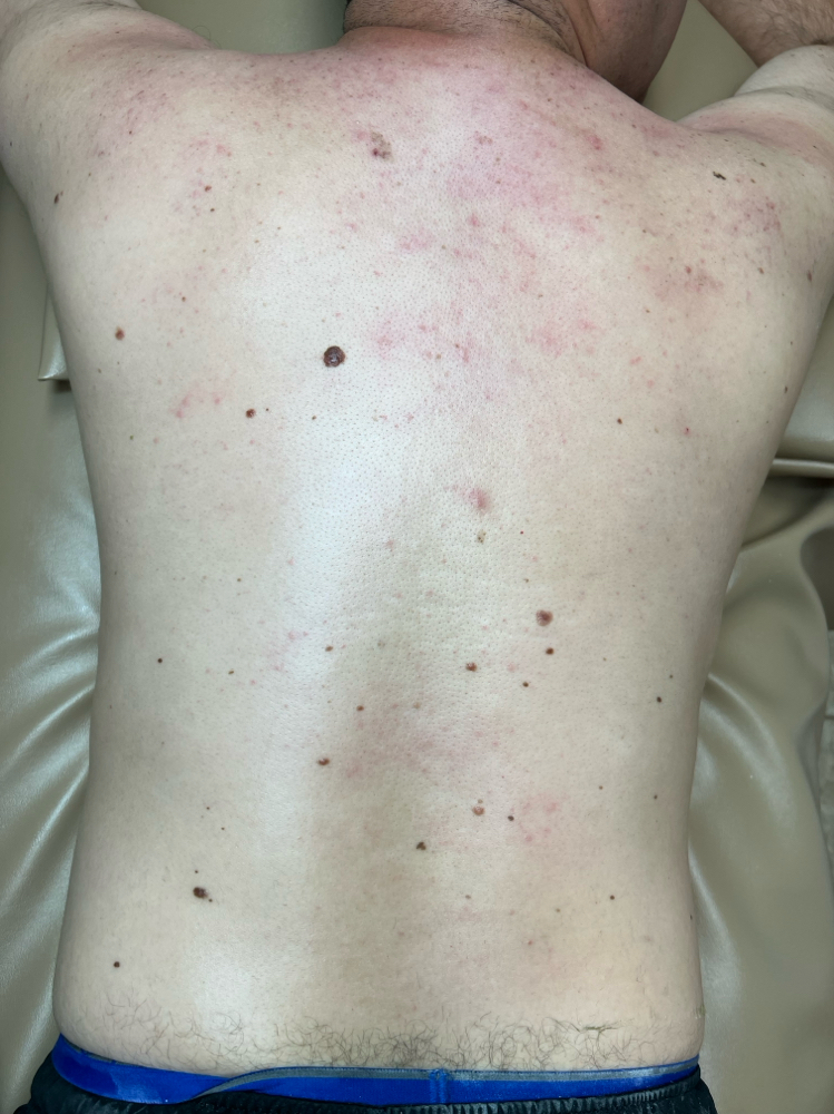 Back Waxing
