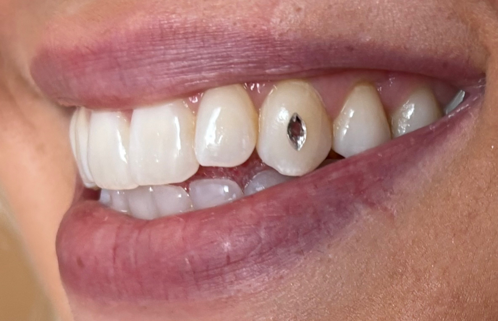 Tooth Gem Application- Shapes