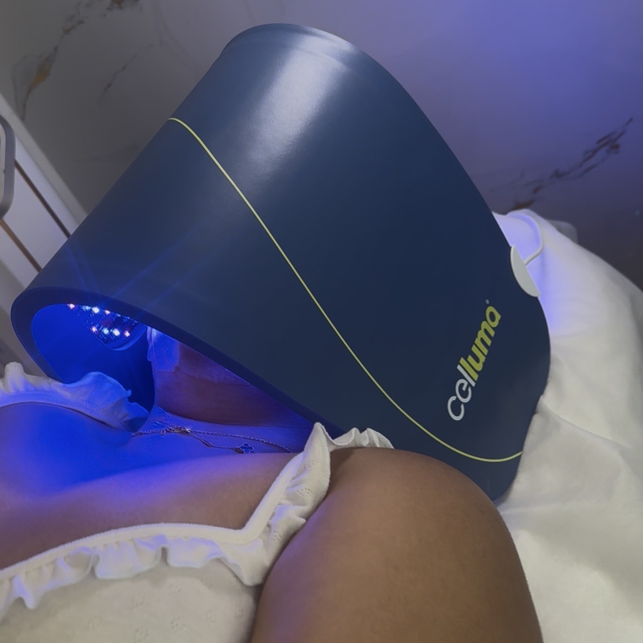Led light therapy at Arewa Essential Medspa in Mamaroneck, NY