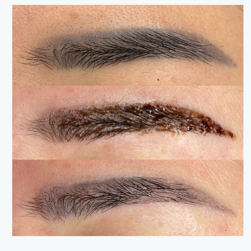 Permanent Makeup Tattoo Removal at Lash & Body Studio, LLC in Houston, TX