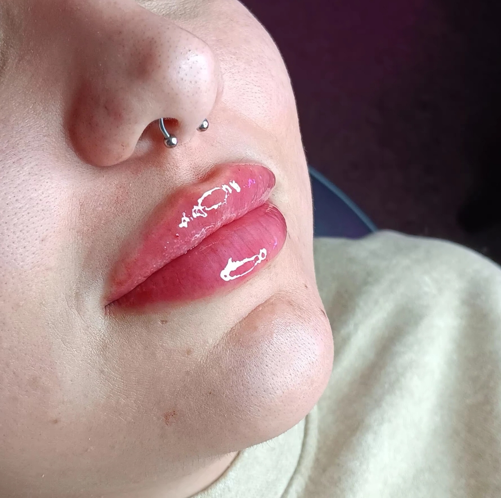 💉👄.8ML