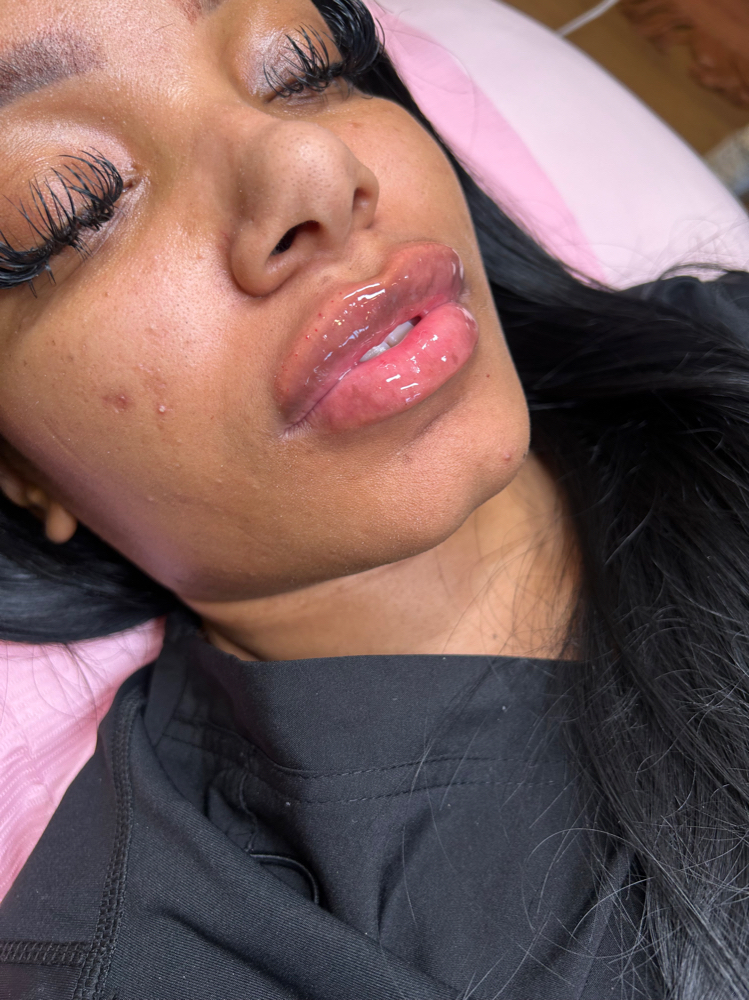 1ML (Very Natural)