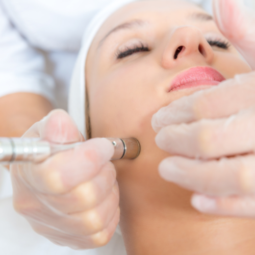 Microdermabrasion Add On