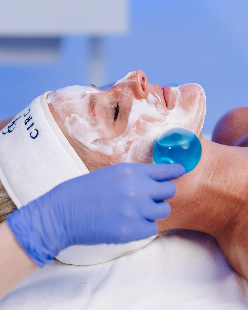 Chemical Peel
