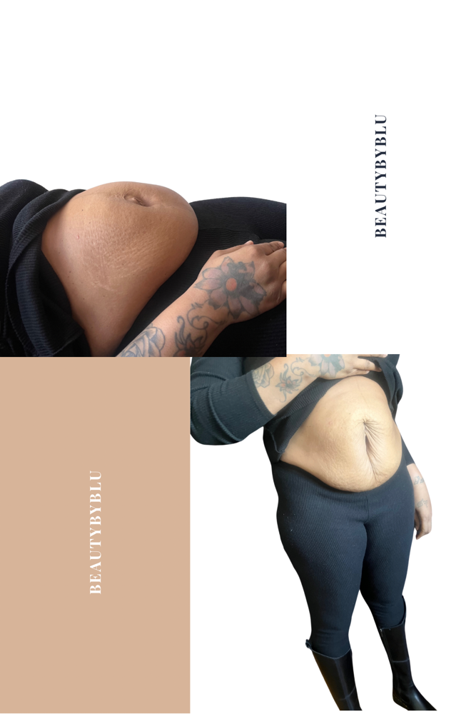 B3 slimming shot