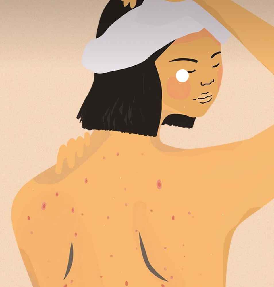Back Facial