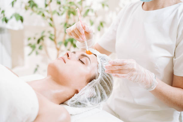 Chemical Peel- Anti Aging & Acne