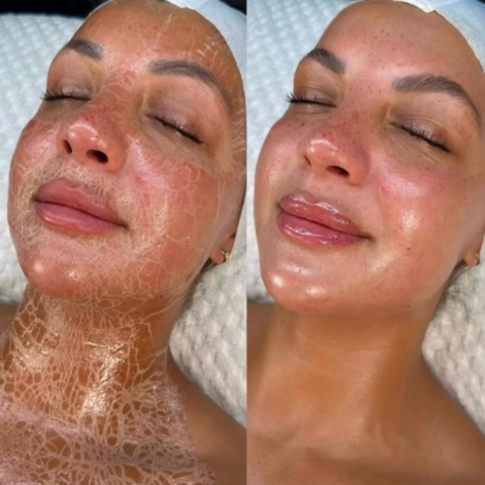 KC Botox Facial Experience at KC Aesthetics Studio in Westport, CT