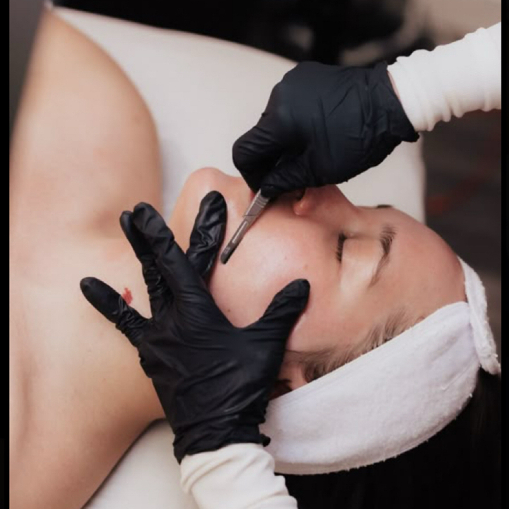 Dermaplane Glow at Sensational Glow in Overland Park, KS