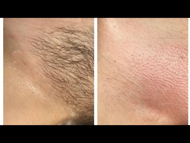 Brazilian Wax(female) at Alicia's Esthetics of Aynor in Aynor, SC