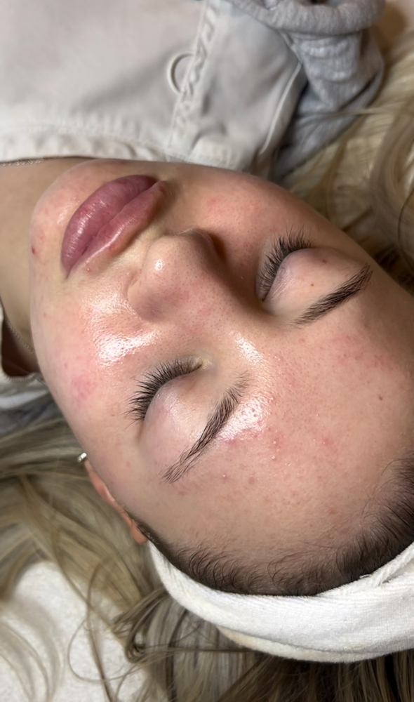 Basic Facial