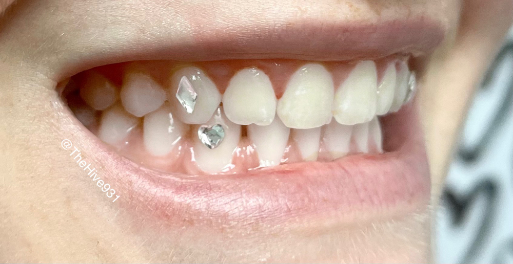 Additional Tooth Gem