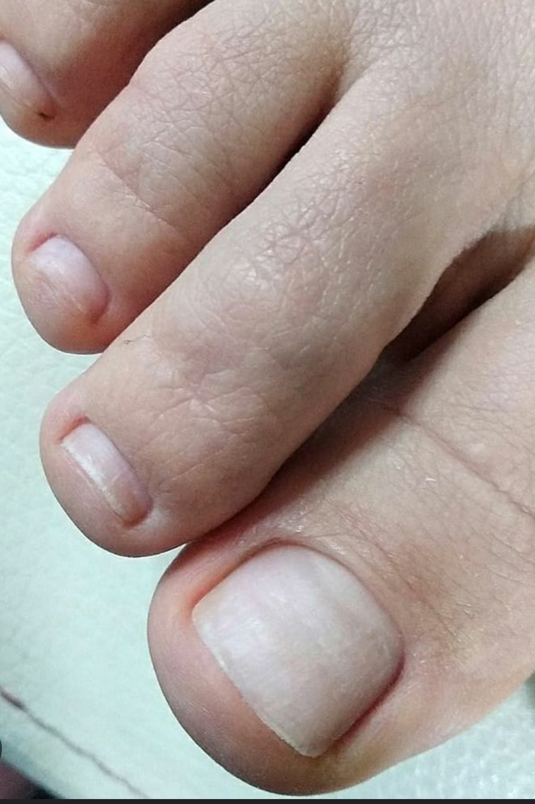 Dry Pedicure Toes Only No Polish