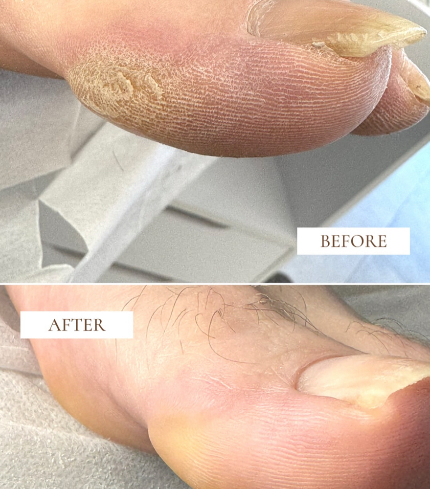 E-FILE PEDICURE (MAN REGULAR PEDI)