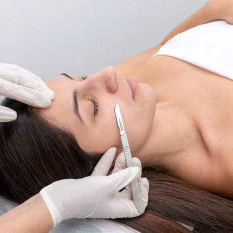 Dermaplaning