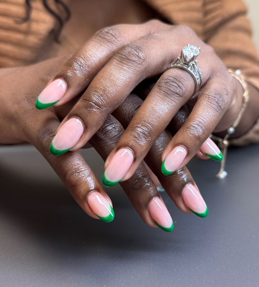 Structured Gel Fill In