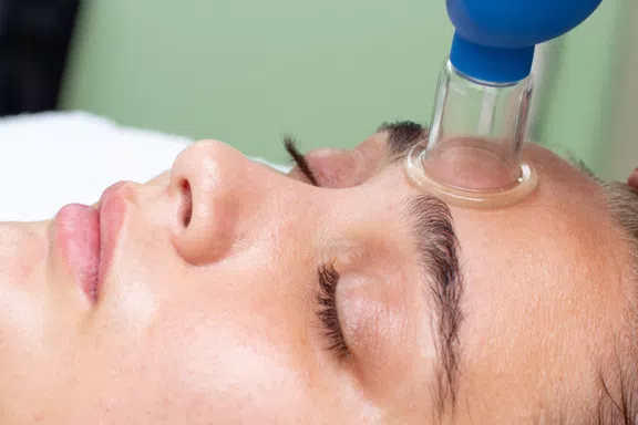 Facial cupping