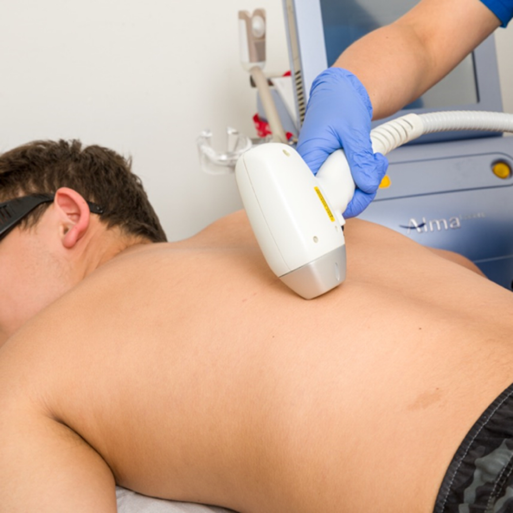 Diodo Laser (espalda) at Diana Bella LLC in Deerfield Beach, FL