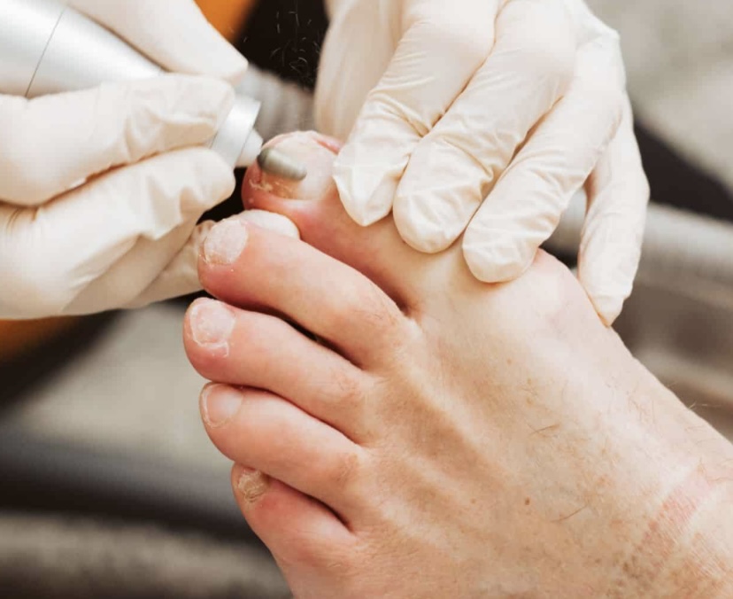 Mobile Or Office Callus + Footcare at Happy Feet & Aesthetics in Plainview, TX