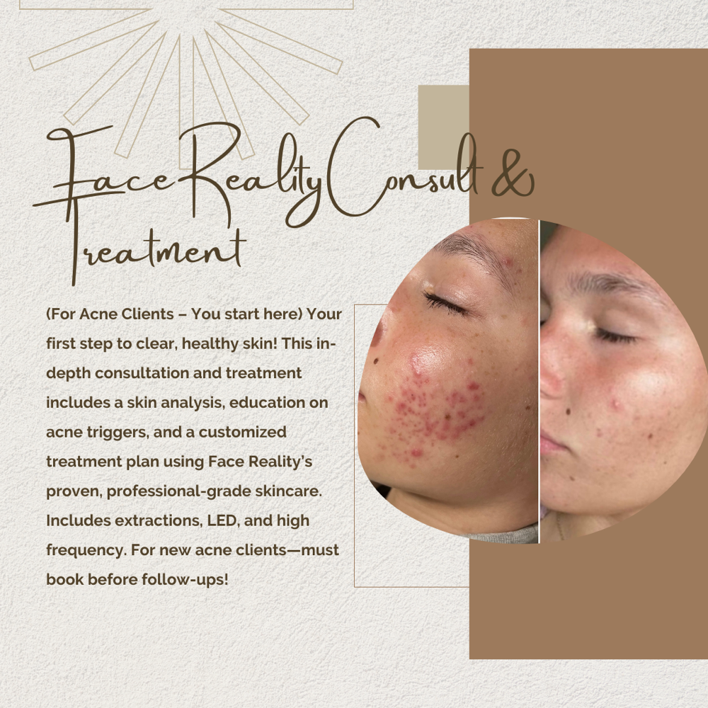 Face Reality Consult + Treatment