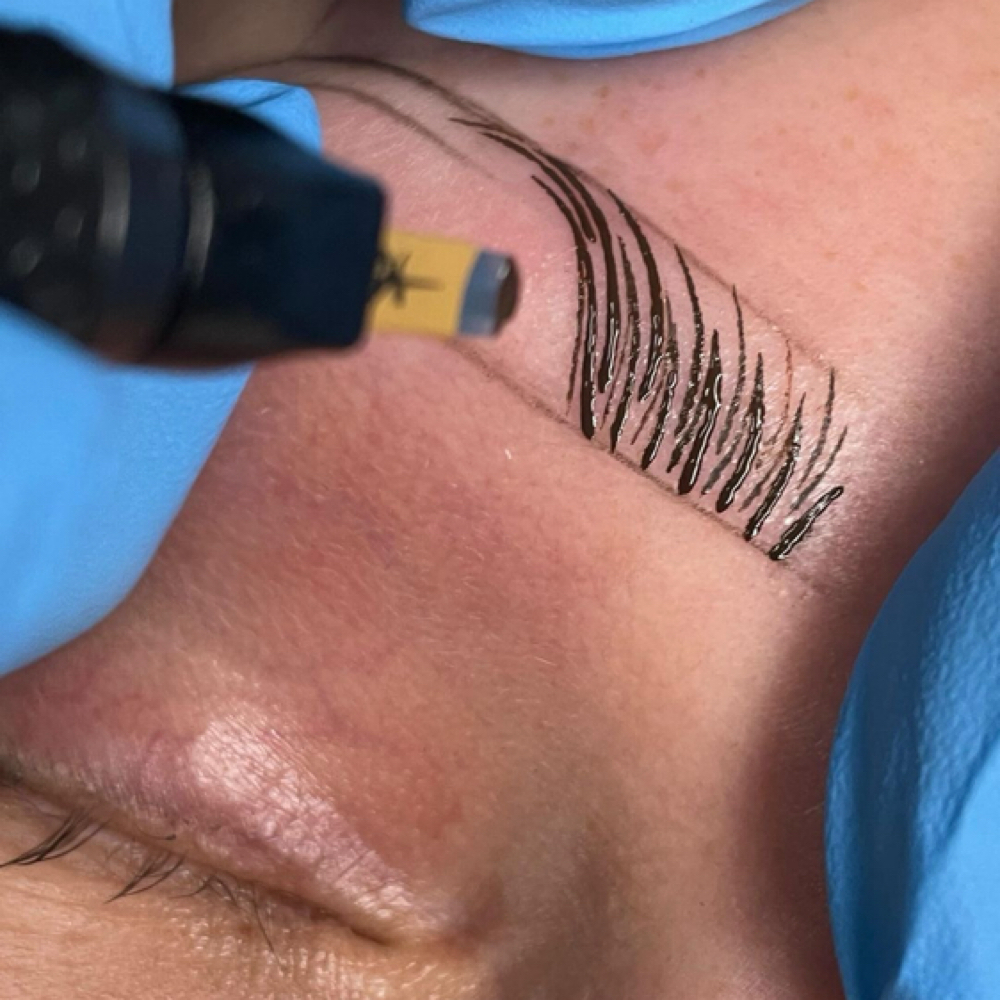 Brows 4/5 Month  touch-up at Lilian Oliveira Aesthetician in Malden, MA