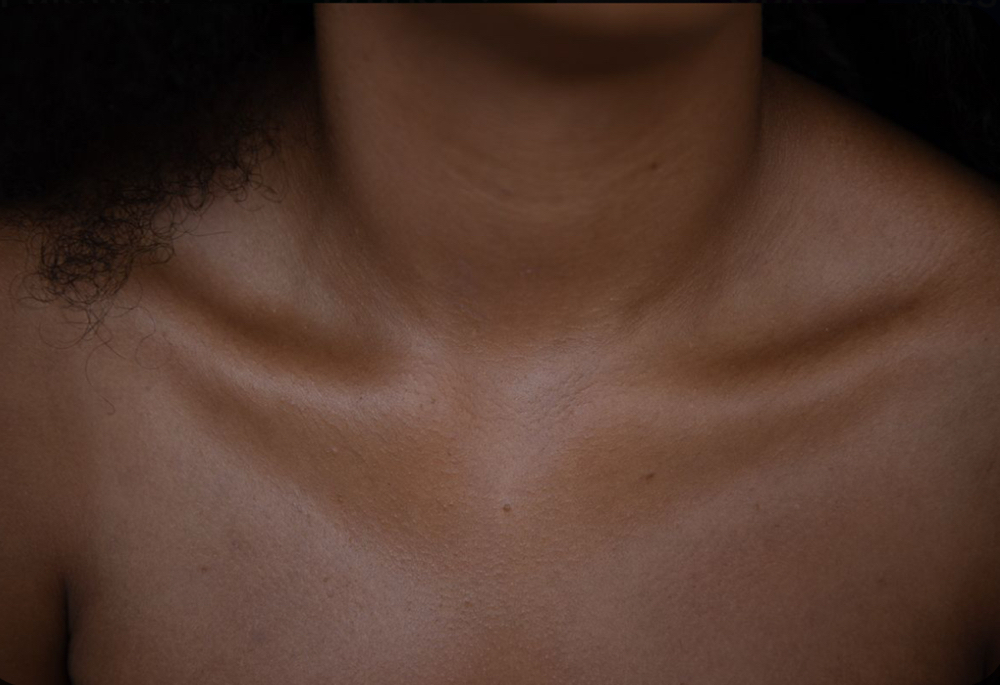 Neck & Décolleté at SÓL Aesthetics & Wellness in las cruces, NM