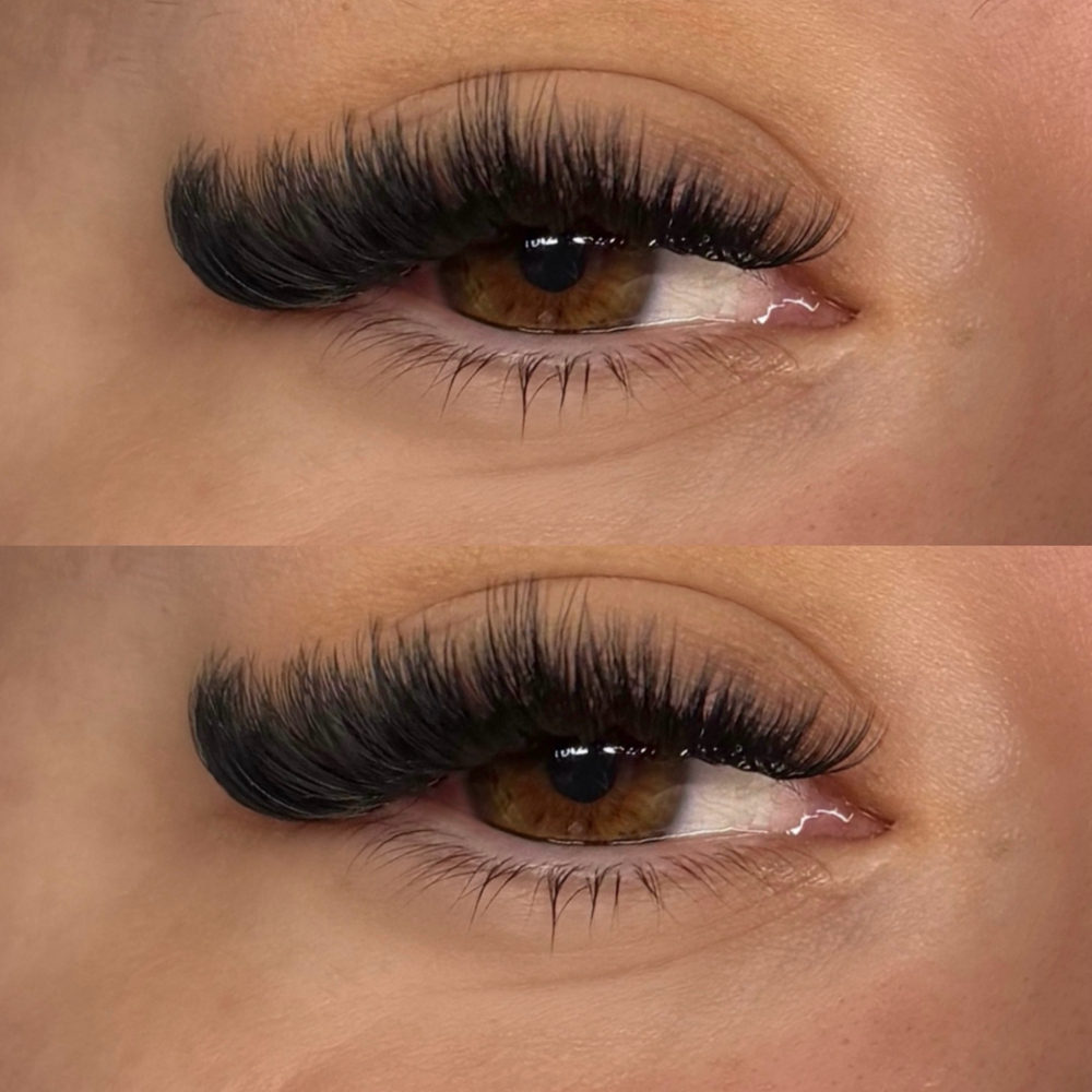 Volume Set at BB Aesthetics in Bakersfield, CA