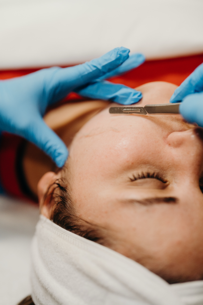 Dermaplane Facial