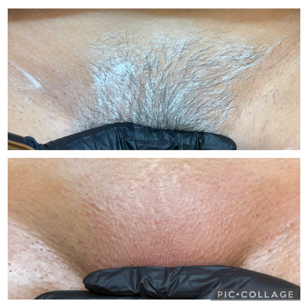 Brazilian Wax at Ali Lanelle Esthetics in summerville, SC