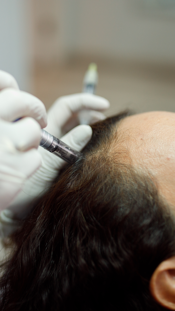 Hair Restoration