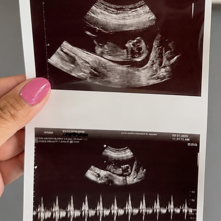 Weekday Baby Peek at San Bernardino 3D 4D Ultrasound by 4D Special Delivery in San Bernardino, CA