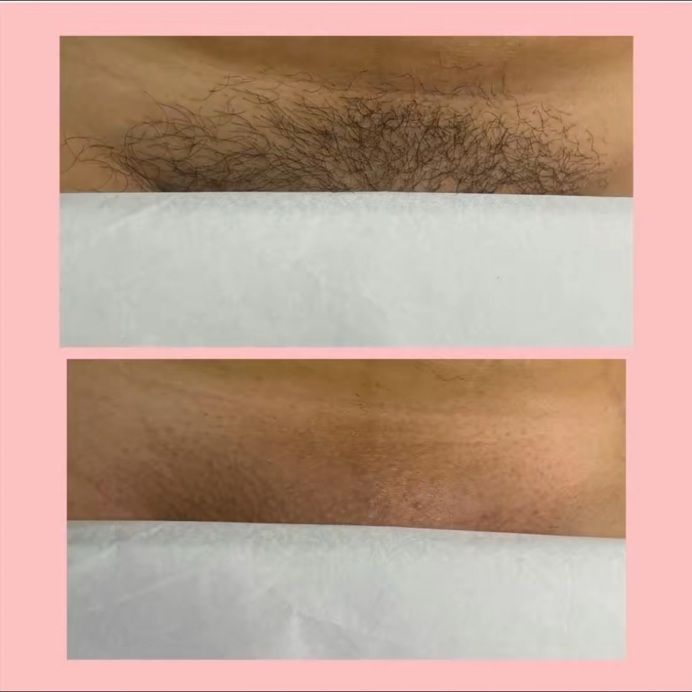 Brazilian Wax at Mad Threading in Rockford, IL