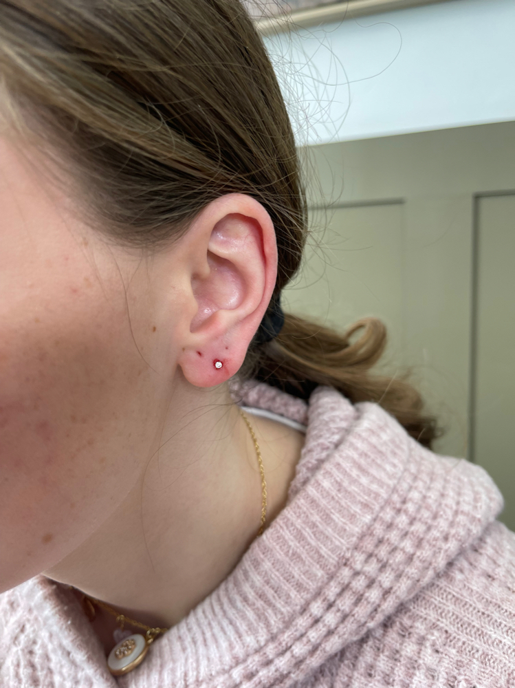 Stacked Lobe