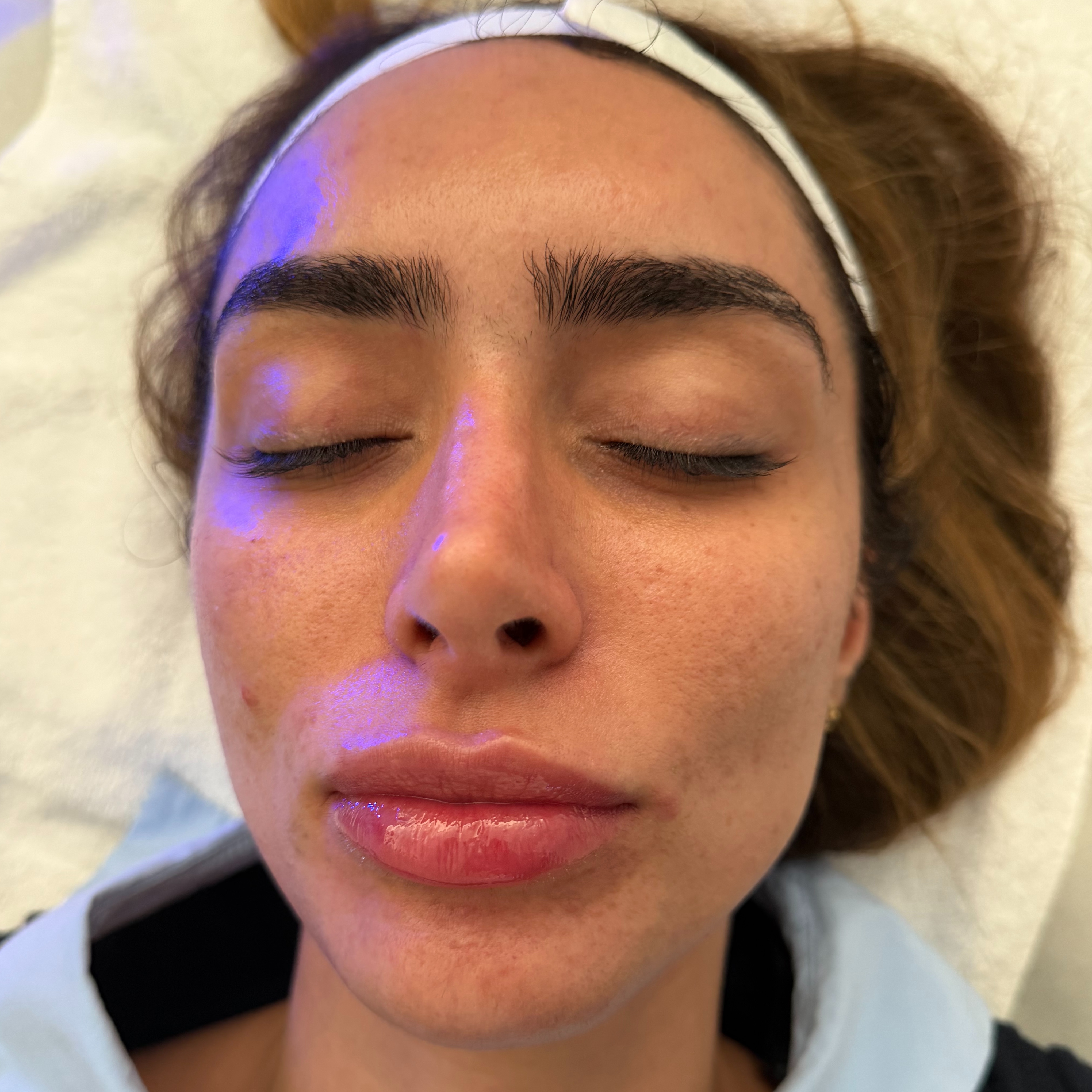 Dermaplane Pro Radiance Facial at Beaute By V in Atlanta, GA