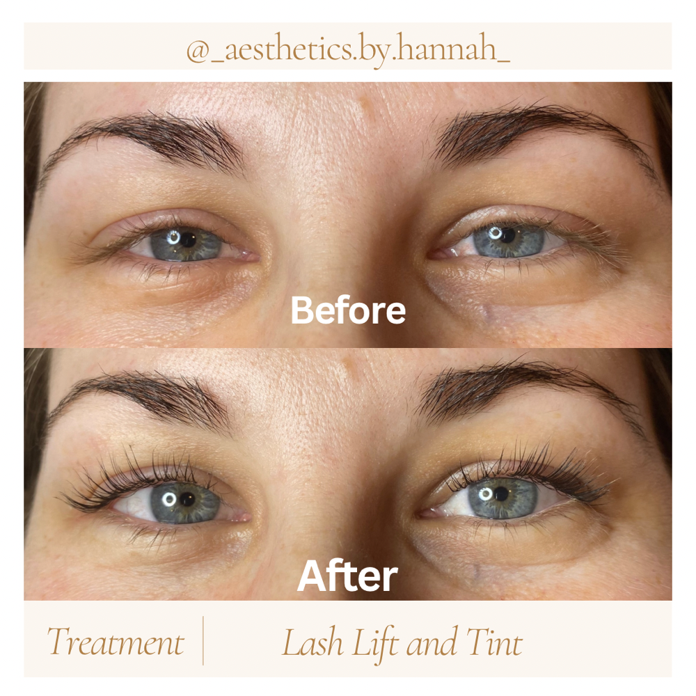 Lash Lift