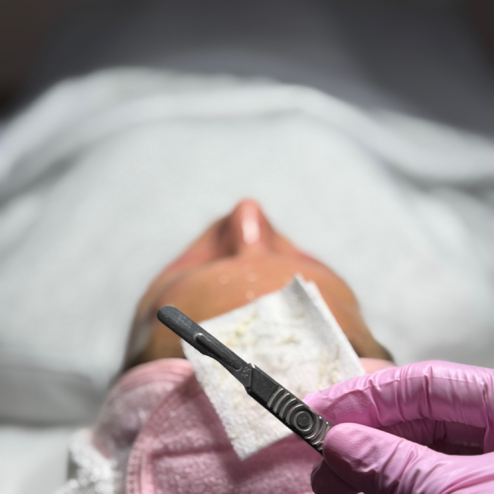 Dermaplane at Tilda’s Room: Esthetics & Wax Studio in Elizabethton, TN
