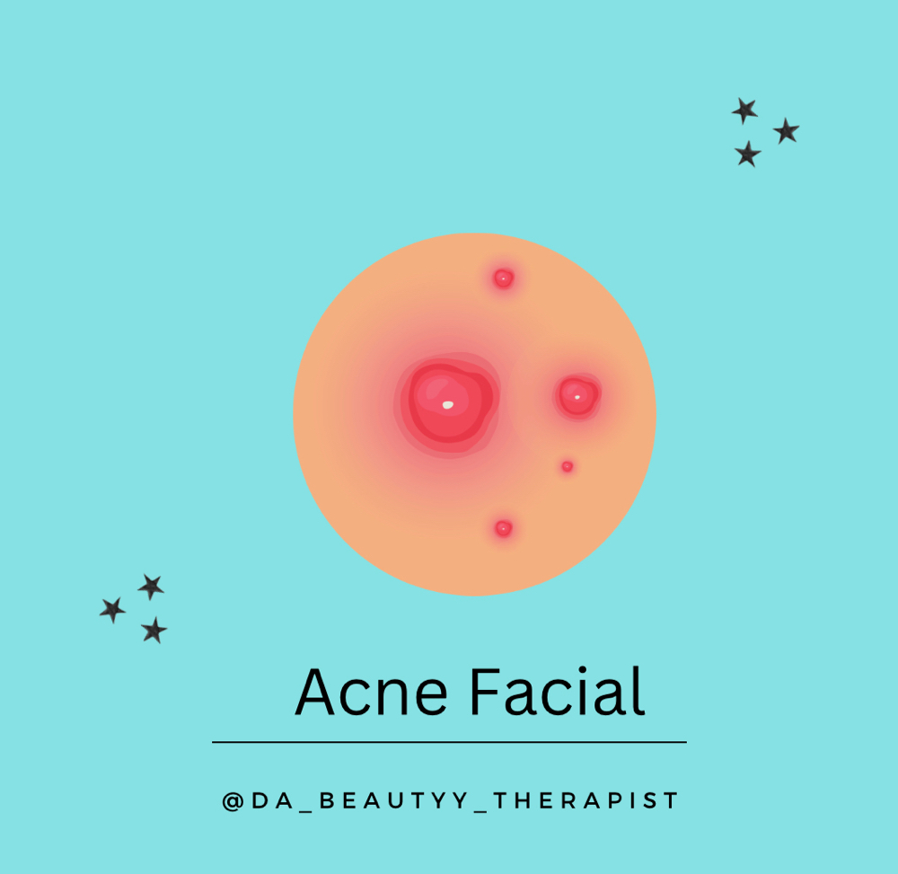 Acne Facial