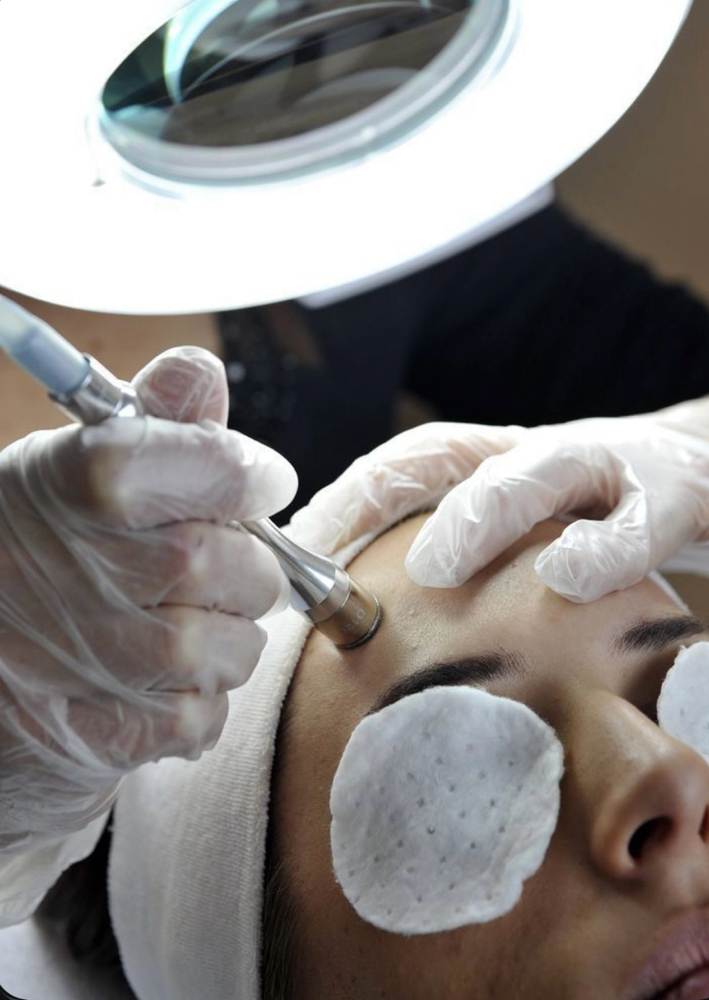 Deep Pore Hydro-Dermabrasion Facial