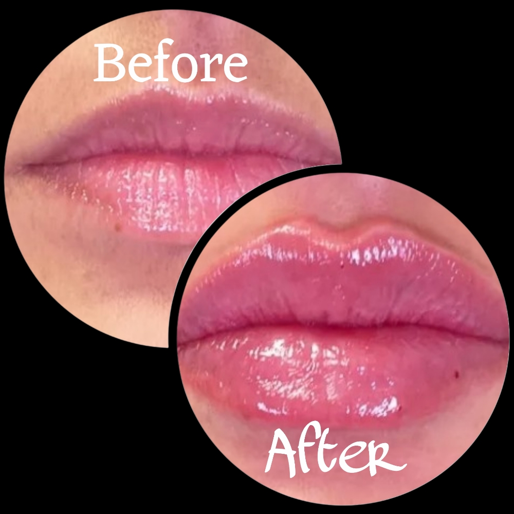 Luscious Lip Filler